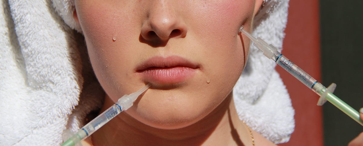 Preventative Botox: The Trend Among Millennials and Gen Z for Youthful Skin